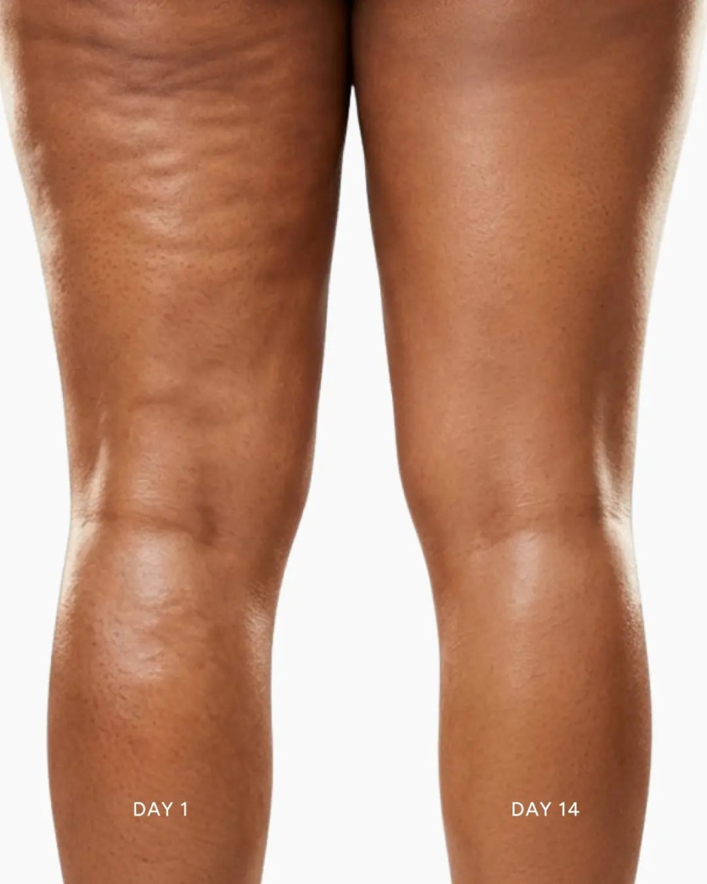 Body Sculpting Device