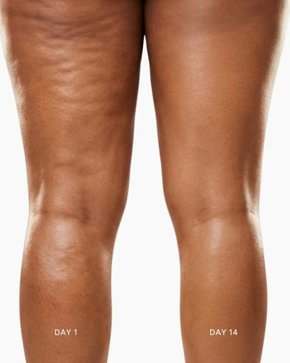 Body Sculpting Device
