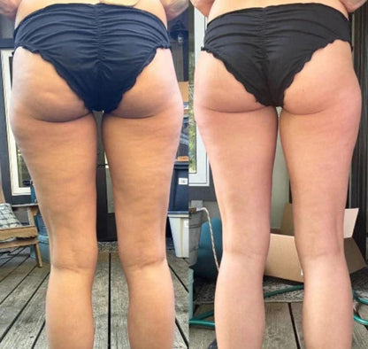 Body Sculpting Device